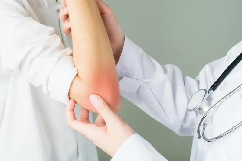 Rheumatologie - Arzt Untersucht Ellenbogen der eine Rötung aufzeigt